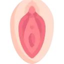Labiaplasty