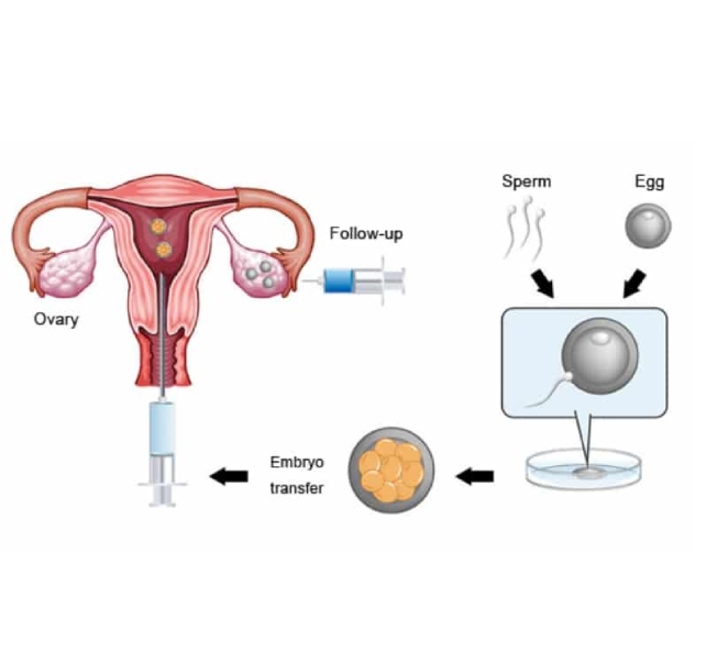 embryo transfer embryo transfer