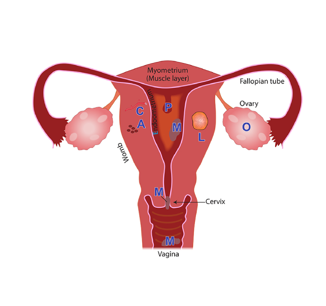 menstrual menstrual