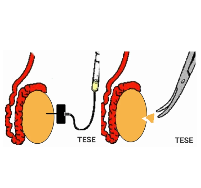 tesa tesa